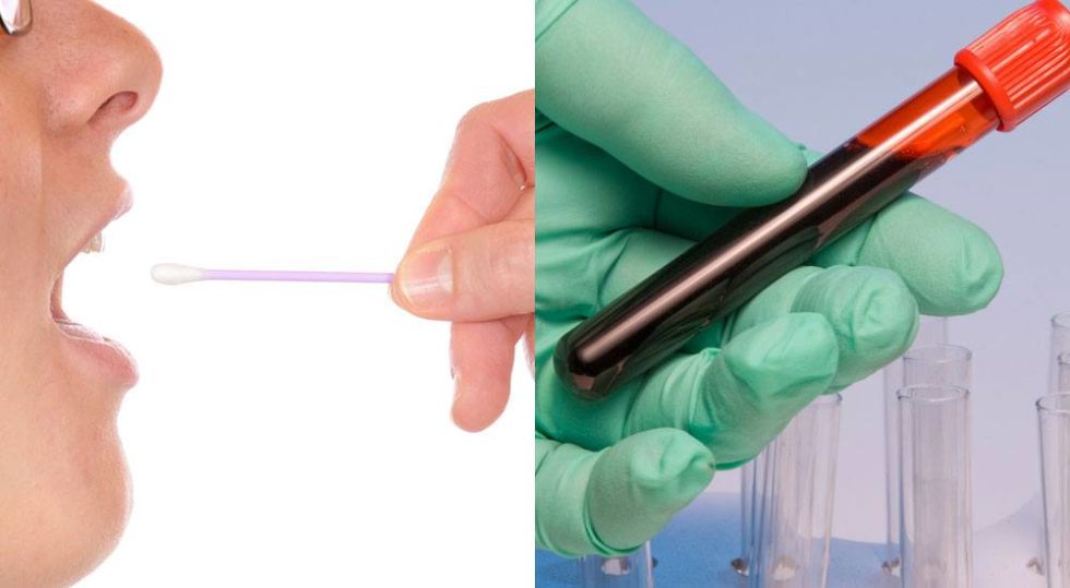 DNA Testing Swabs vs. Blood Samples DDC UK DEV